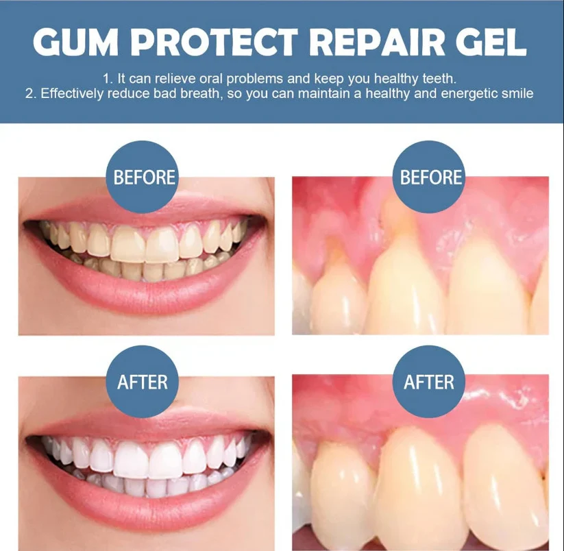 Raznave® Teeth Repair Gel – Professional At-Home Whitening